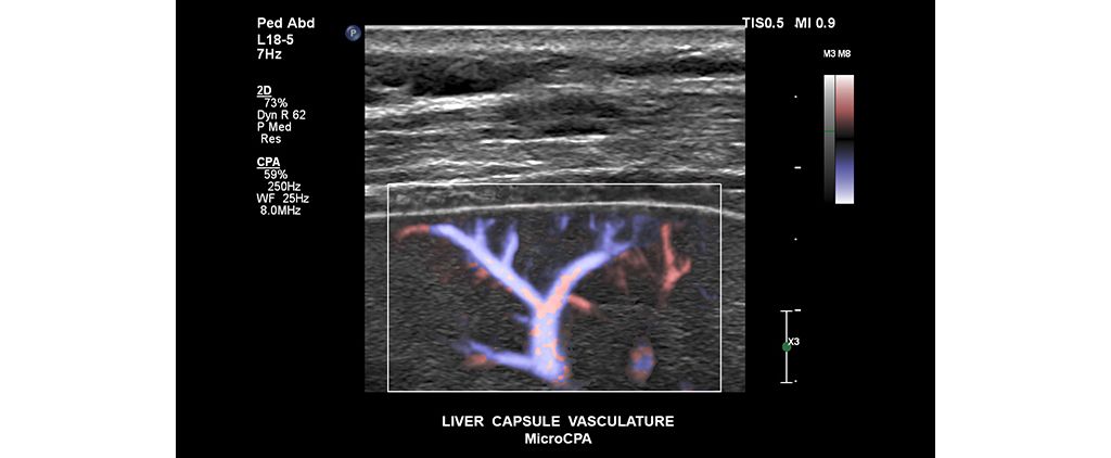 Liver capsule vasculature MicroCPA