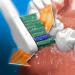 Visapusė dantenų priežiūra