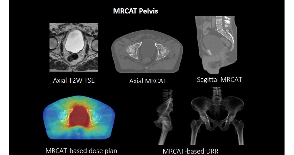 MRCAT Pelvis