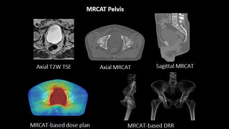 MRCAT Pelvis