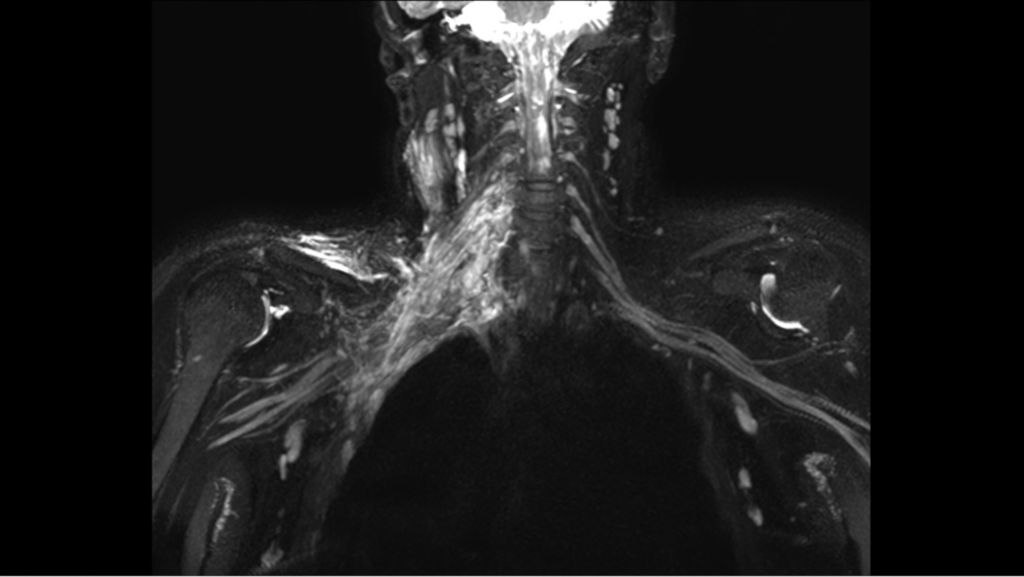 3D NerveVIEW