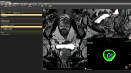 Use tools designed for urology