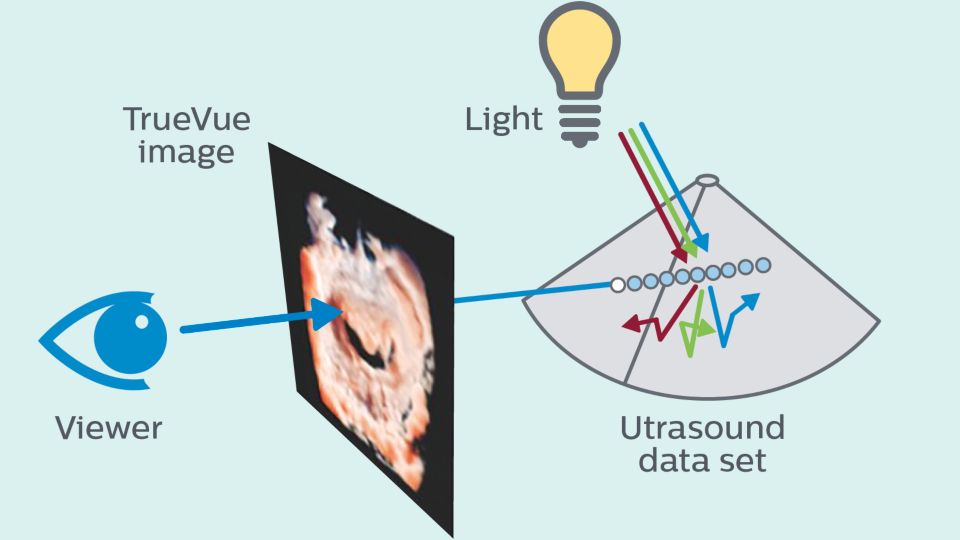 TrueVue adds a virtual light source and simulates light-tissue interactions