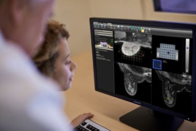 Clinicians reviewing breast imaging data using Philips DynaCAD software