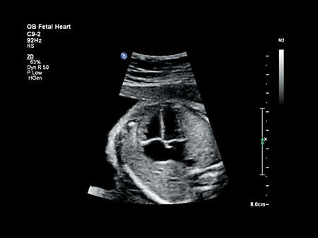 C9-2 Fetal heart