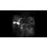 SmartSpeed - Abdomen thumbnail