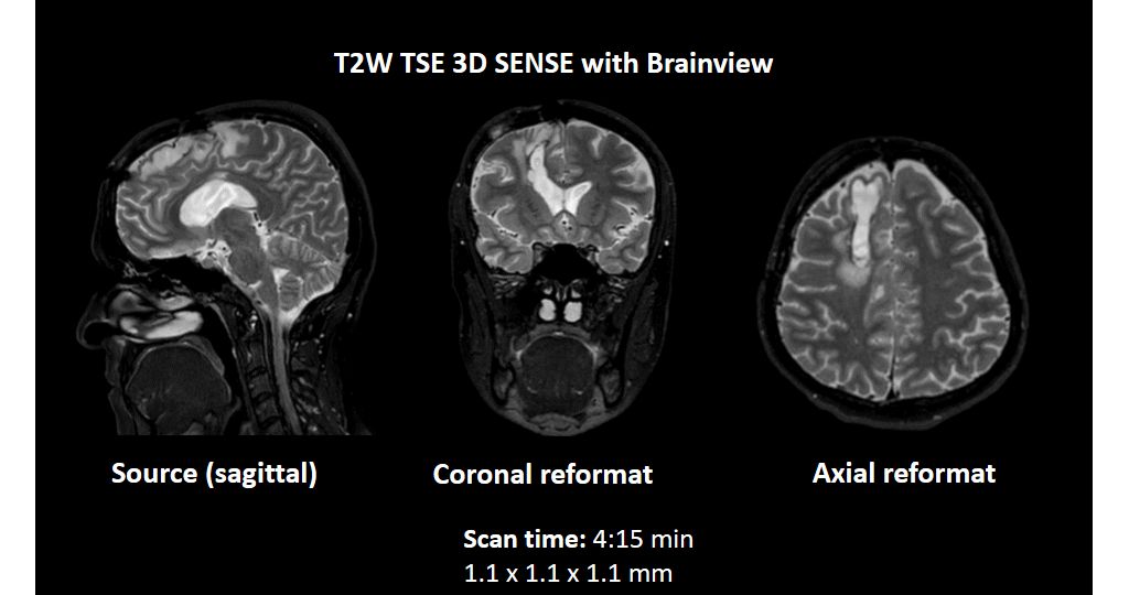 3D BrainView