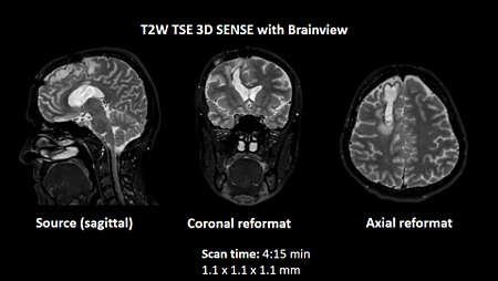 3D BrainView
