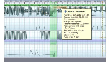 Objective data you can use to achieve high-quality CPR