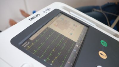Dispositivo de monitoramento de ECG da Philips exibindo dados do ritmo cardíaco do paciente