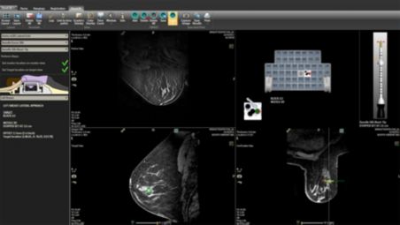 Enhanced workflow for biopsy procedures