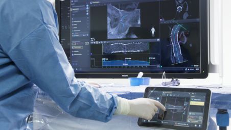 Peri-procedure check of positioning of flow-diverter stents​