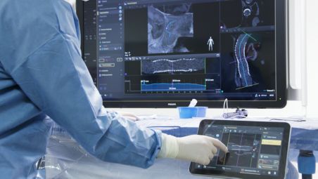 Peri-procedure check of positioning of flow-diverter stents