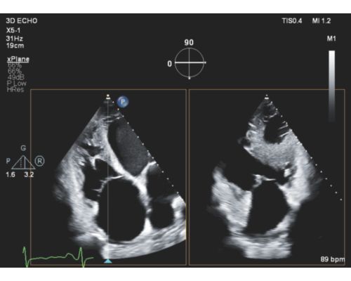 Ultrasound Web xPlane x5 RV