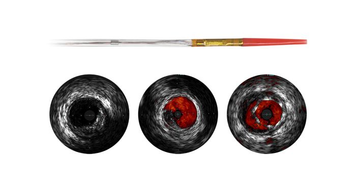 Eagle Eye Platinum  Digital IVUS catheter