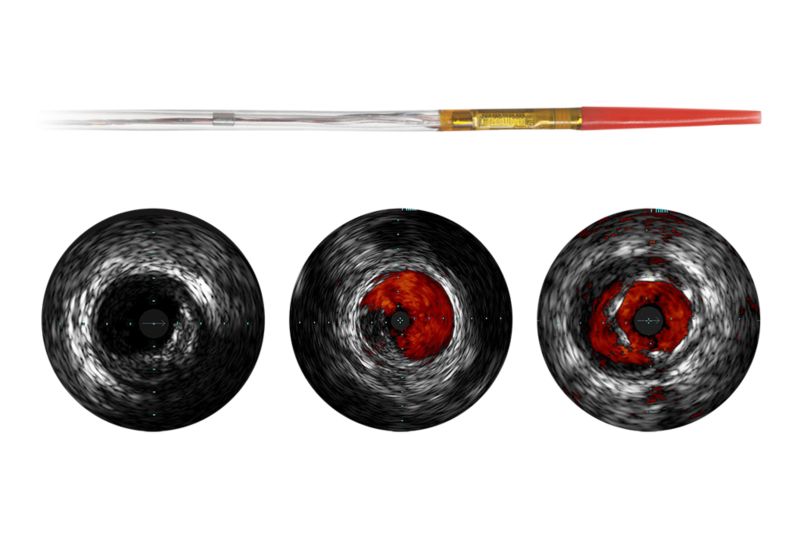 Eagle Eye Platinum — Digital IVUS Catheter