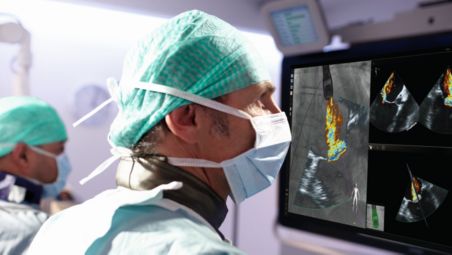 EchoNav – intuitively fusing live X-ray and live echo