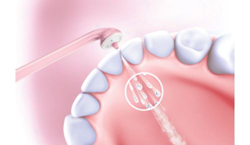 Technologie, die auf Knopfdruck reinigt