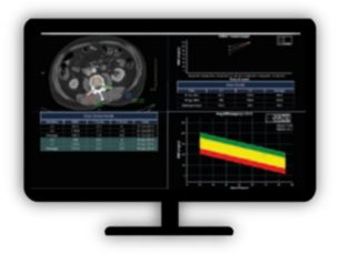 CT Bone Mineral Analysis Track degenerative and metabolic bone disease