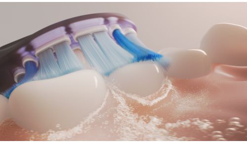 Dokumenteret Sonicare-teknologi