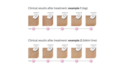 Efficacia senza sforzo