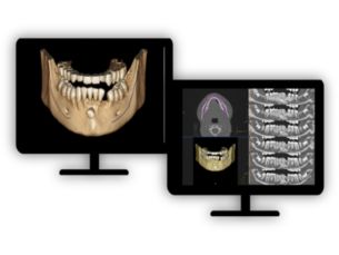 CT Dental Planning Planning for oral procedures