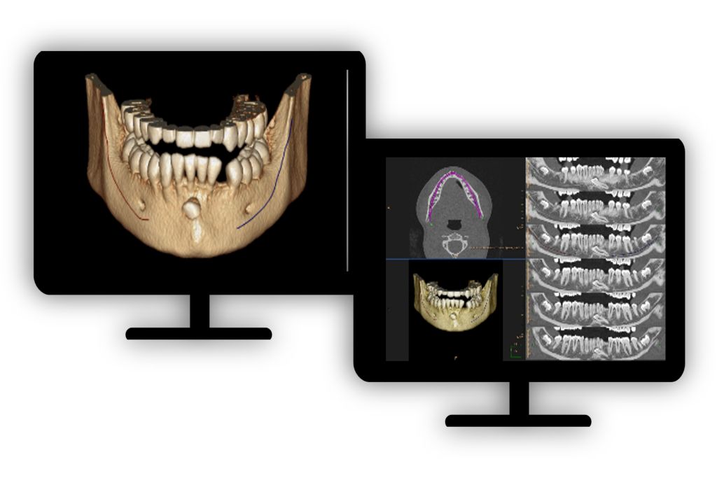 Standard product photograph