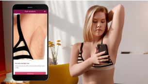 Analyse intelligente de la pilosité avec SkinAI
