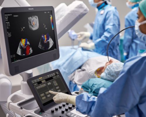 Cardiac Ultrasound machine