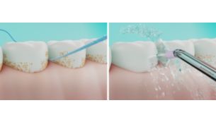 Up to 150% more effective than floss in improving gum health