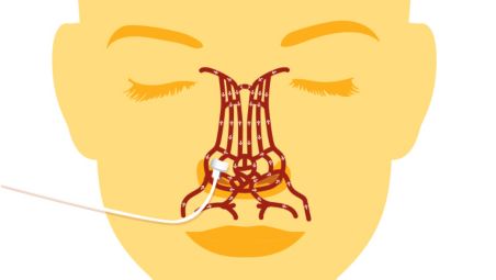 Le positionnement au niveau de l’aile du nez fournit des mesures fiables