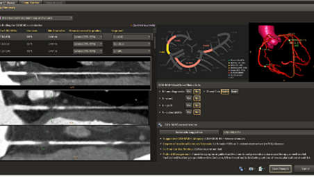 Comprehensive cardiac analysis with CAD-RADS functionality