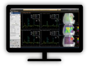 MR SpectroView Review metabolite maps