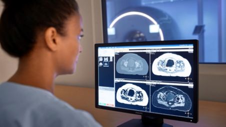 MR-only radiotherapy planning