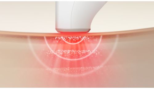 Experiencia relajante y cálida con SkinLED