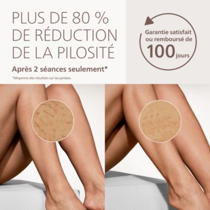 Dites adieu aux poils, et bonjour à une peau lisse
