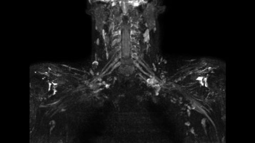

3D NerveVIEW

