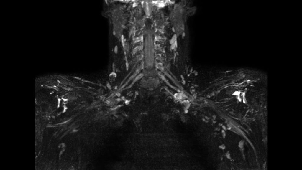 

3D NerveVIEW

