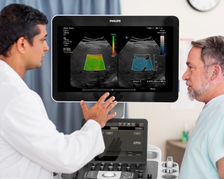 Liver Ultrasound