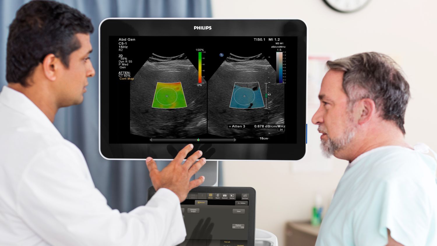 EPIQ Elite LFQ imaging