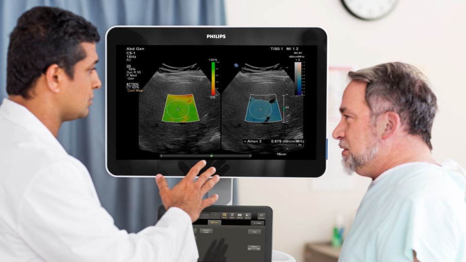 EPIQ Elite LFQ imaging