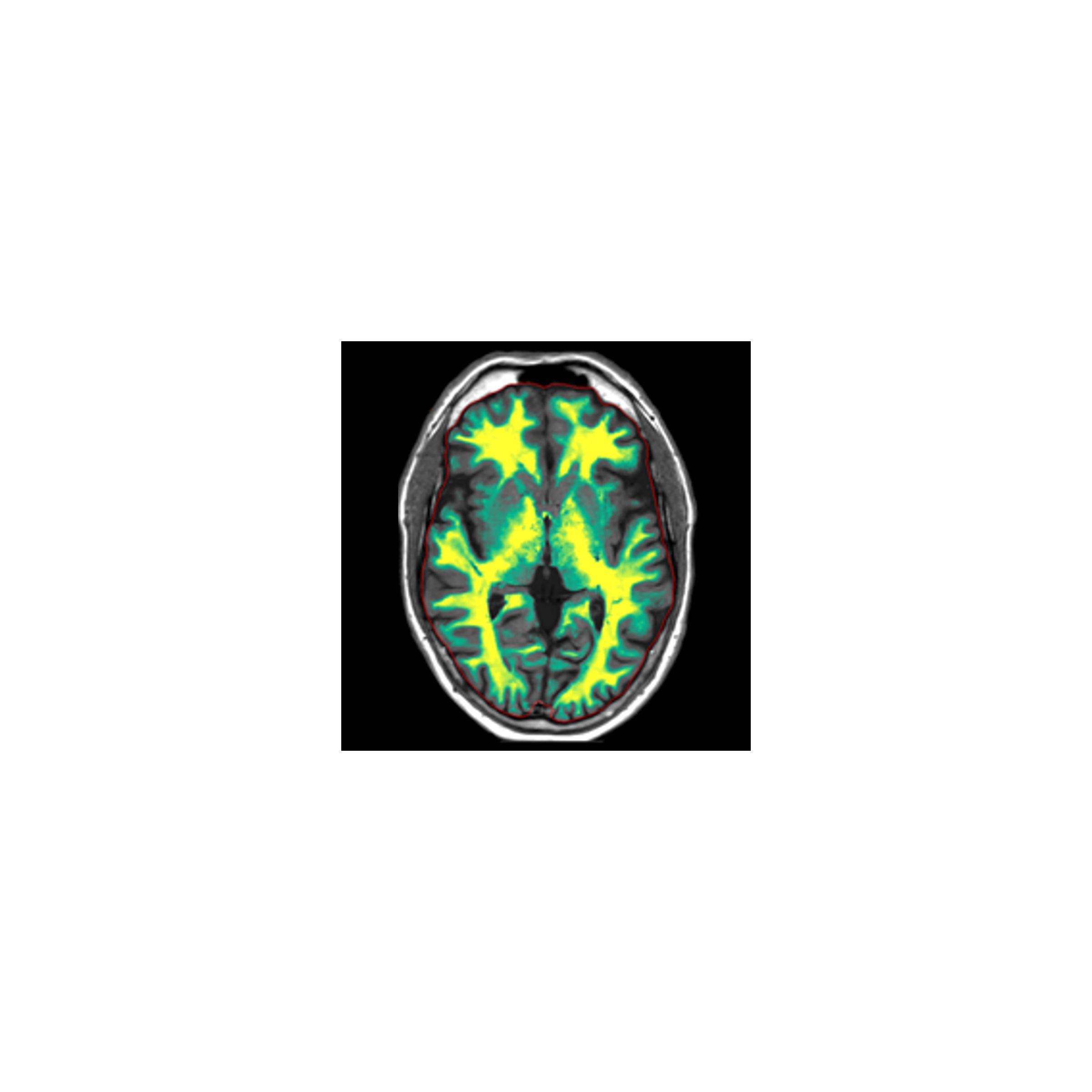 SmartQuant Neuro