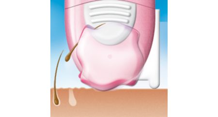 نظام إزالة الشعر الفريد من Philips