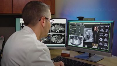 Philips Collaboration Live use case with Dr. Michael Ruma (English subtitles)