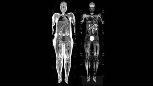 Whole Body