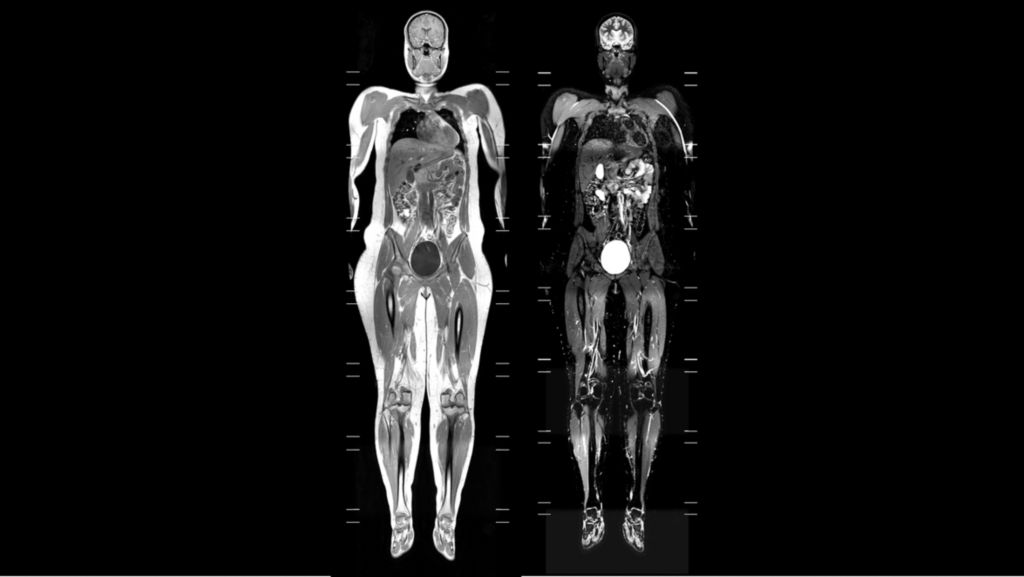 Whole Body