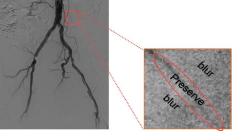 Visibilidade vascular aprimorada