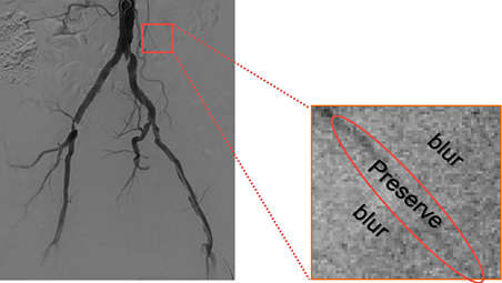 Enhancing clinically relevant structures for vascular procedures
