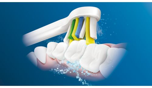 Die fortschrittliche Philips Sonicare-Schalltechnologie