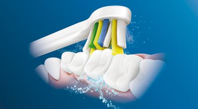 Philips Sonicare's advanced sonic technology